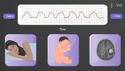 bilgilendirme-decoding-the-mind-brainwave-based-innovations-in-psychological-assessment-and-treatment-16-05-2025-r2.jpg
